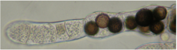  Allomyces javanicus infected with Rozella allomycis. Unwalled sporangia at the left fill host compartments. Dark -spiny walled resting spores fill host compartments at right 